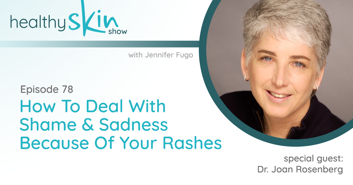 078: How To Deal With Shame & Sadness Because Of Your Rashes w/ Dr. Joan Rosenberg
