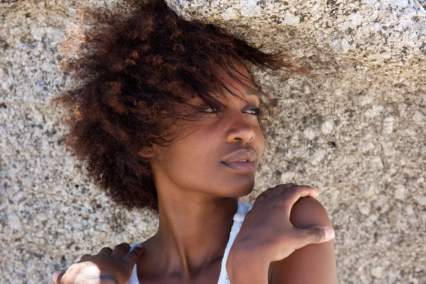168: Misdiagnosis of Chronic Skin Conditions In Skin of Color w/ Dr ...
