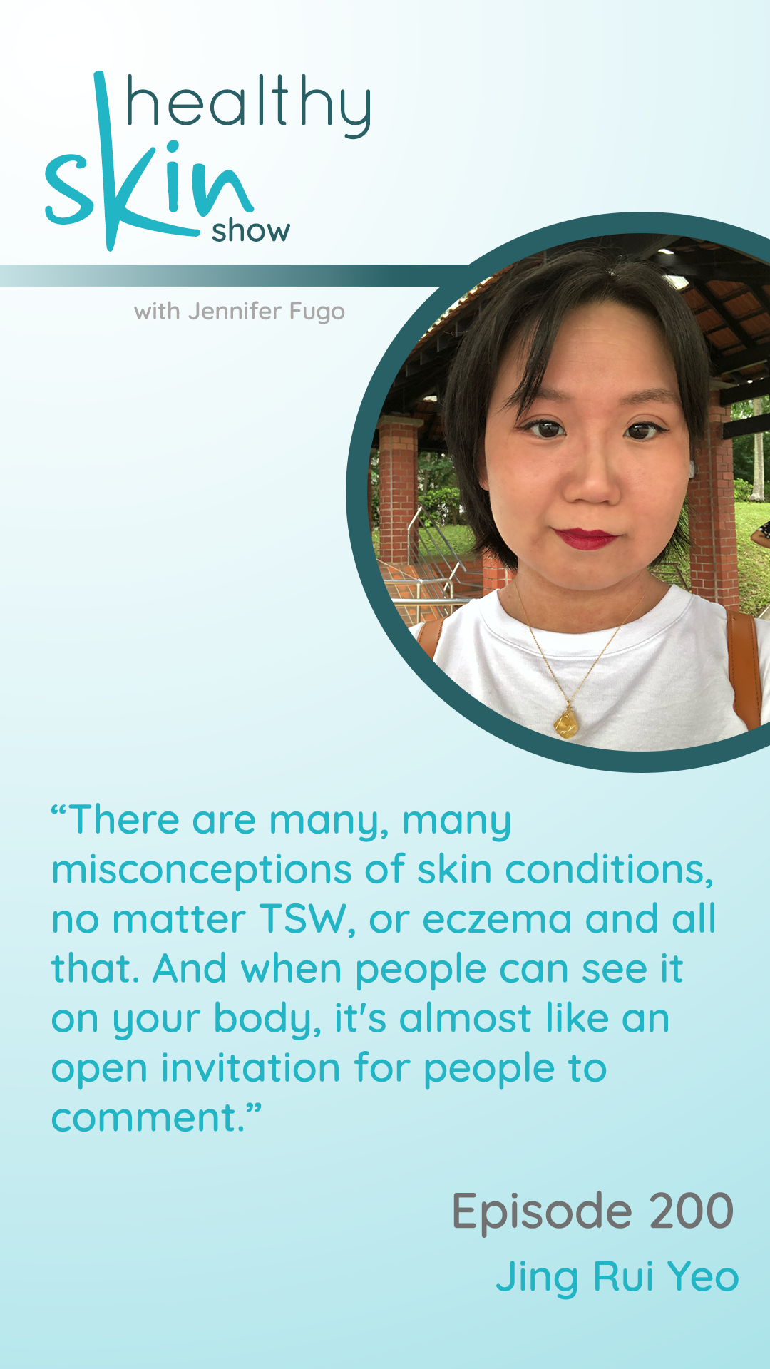 “There are many, many misconceptions of skin conditions, no matter TSW, or eczema and all that. And when people can see it on your body, it's almost like an open invitation for people to comment.”
