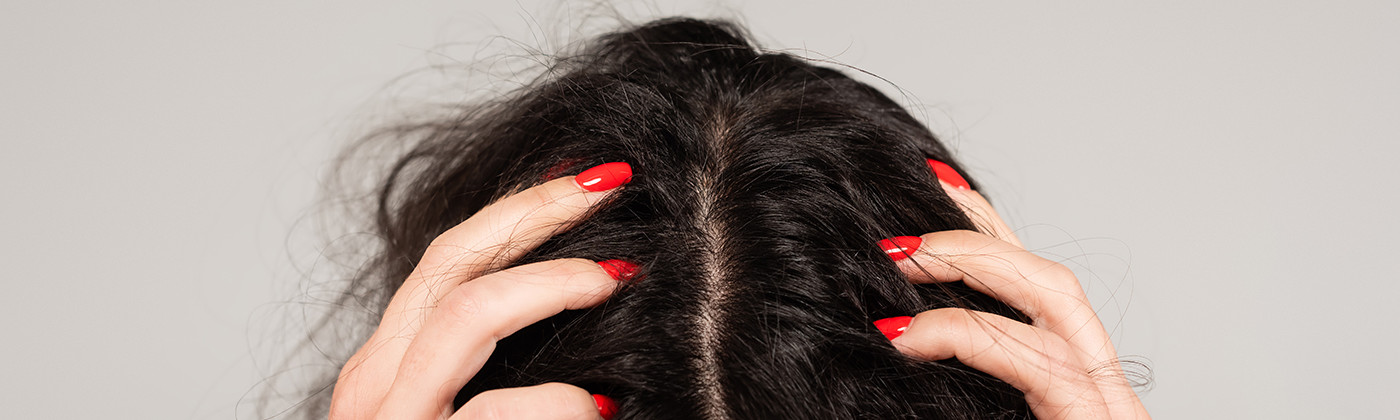 woman with scalp psoriasis scratching her scalp