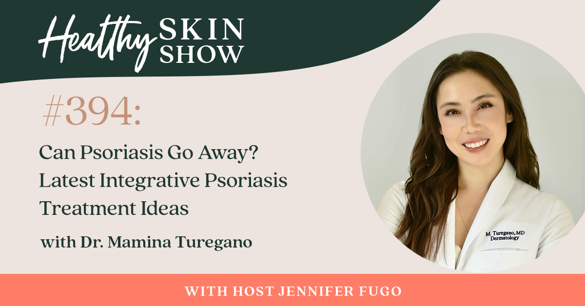 psoriasis treatment