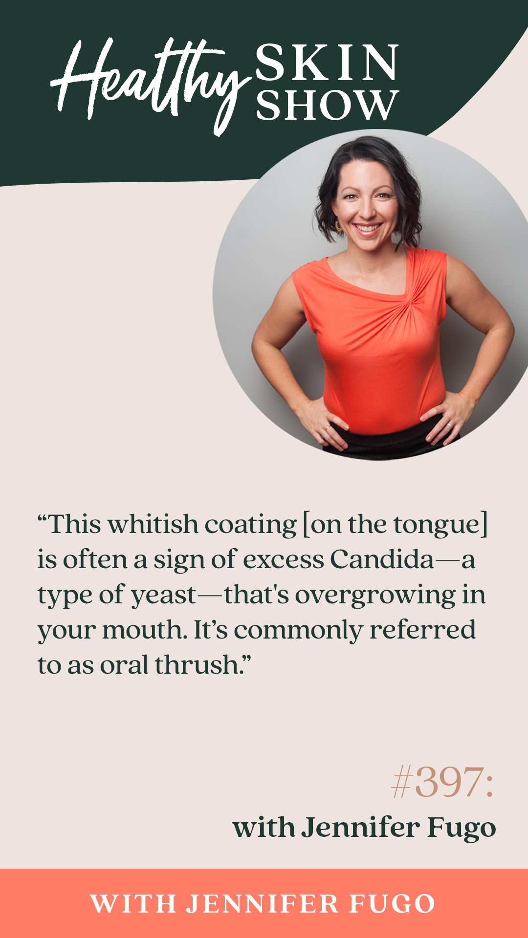 oral thrush