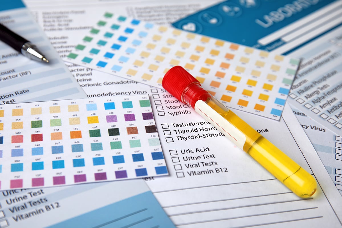 medical tests for helminth infections and other things